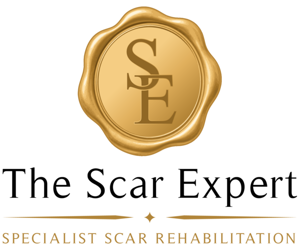 The Scar Expert